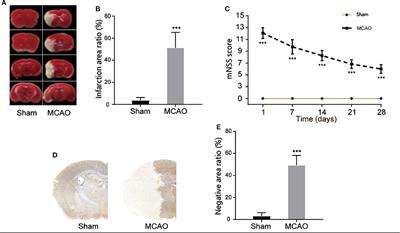 Ablation of GSDMD Improves Outcome of Ischemic Stroke Through Blocking Canonical and Non-canonical Inflammasomes Dependent Pyroptosis in Microglia